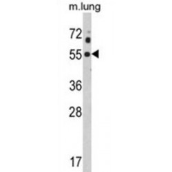 Potassium Voltage-Gated Channel Subfamily J Member 2 (KCNJ2) Antibody