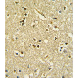 Paired Box Protein Pax-6 (PAX6) Antibody