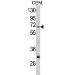 NADH Dehydrogenase 5 (ND5) Antibody