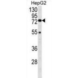 Beta-Hexosaminidase Subunit Alpha (HEXA) Antibody