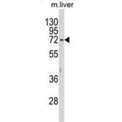 Beta-Hexosaminidase Subunit Alpha (HEXA) Antibody