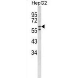 Beta-Hexosaminidase Subunit Alpha (HEXA) Antibody