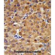 Cystathionine Beta-Synthase (CBS) Antibody