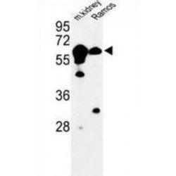 Cystathionine Beta-Synthase (CBS) Antibody
