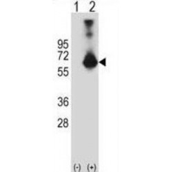 Cystathionine Beta-Synthase (CBS) Antibody