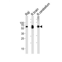 Cystathionine Beta-Synthase (CBS) Antibody