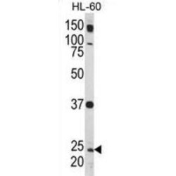 Ras-Related Protein Rab-5A (Rab5) Antibody