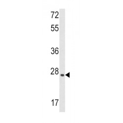 Leukemia Inhibitory Factor (LIF) Antibody