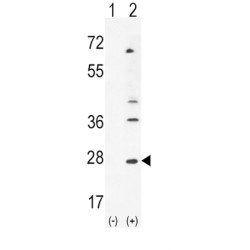 Leukemia Inhibitory Factor (LIF) Antibody