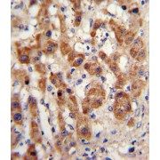 Arylamine N-Acetyltransferase 2 (NAT2) Antibody