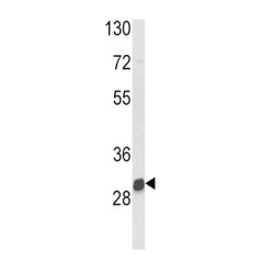 Arylamine N-Acetyltransferase 2 (NAT2) Antibody