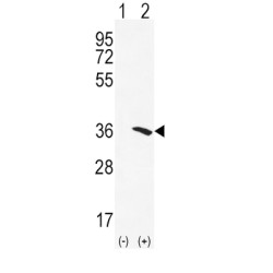 Arylamine N-Acetyltransferase 2 (NAT2) Antibody