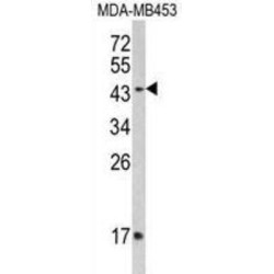 Interferon Gamma Receptor 2 (IFNGR2) Antibody