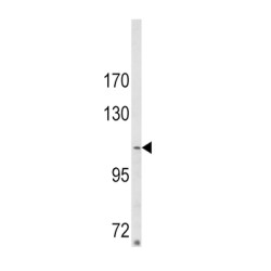 Arg-Binding Protein 2 (ARGBP2) Antibody