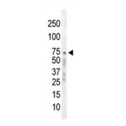 Adrenergic Receptor Beta Kinase 1 (ADRBK1) Antibody