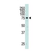 Beta-Adrenergic Receptor Kinase 2 (GRK3) Antibody