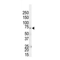 G Protein Coupled Receptor Kinase 4 (GRK4) Antibody