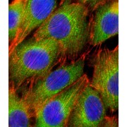 RAC-Beta Serine/threonine-Protein Kinase (AKT2) Antibody