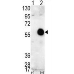 RAC-Beta Serine/threonine-Protein Kinase (AKT2) Antibody