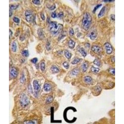 RAC-Beta Serine/threonine-Protein Kinase (AKT2) Antibody