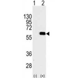 RAC-Beta Serine/threonine-Protein Kinase (AKT2) Antibody