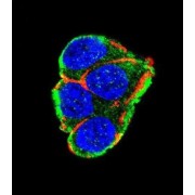 RAC-Beta Serine/threonine-Protein Kinase (AKT2) Antibody