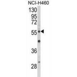 RAC-Beta Serine/threonine-Protein Kinase (AKT2) Antibody