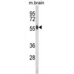 RAC-Beta Serine/threonine-Protein Kinase (AKT2) Antibody