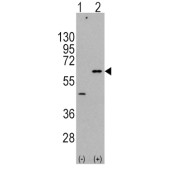 RAC-Gamma Serine/threonine-Protein Kinase (AKT3) Antibody