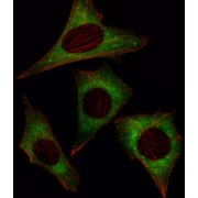 Mps One Binder Kinase Activator-Like 1A (MOB4A) Antibody