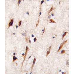 Mps One Binder Kinase Activator-Like 1A (MOB4A) Antibody