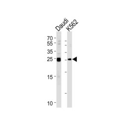 Mps One Binder Kinase Activator-Like 1A (MOB4A) Antibody