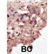 Death-Associated Protein Kinase 2 (DAPK2) Antibody