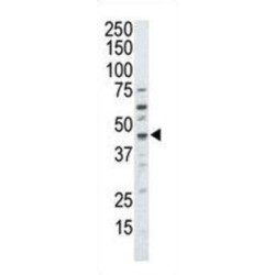 Death-Associated Protein Kinase 2 (DAPK2) Antibody