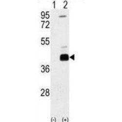 Death-Associated Protein Kinase 2 (DAPK2) Antibody