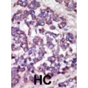 Large Tumor Suppressor Kinase 1 (LATS1) Antibody