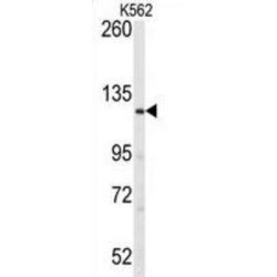 Large Tumor Suppressor Kinase 1 (LATS1) Antibody