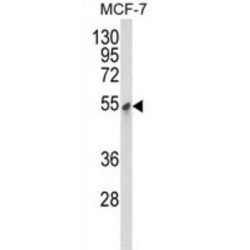 Pyruvate Dehydrogenase Kinase Isozyme 3 (PDK3) Antibody