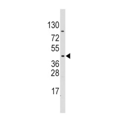 Pyruvate Dehydrogenase Kinase Isozyme 4 (PDK4) Antibody