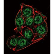 Pyruvate Dehydrogenase Kinase Isozyme 4 (PDK4) Antibody