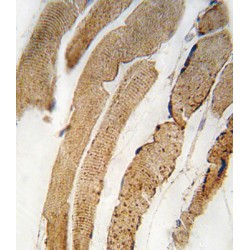 Pyruvate Dehydrogenase Kinase Isozyme 4 (PDK4) Antibody