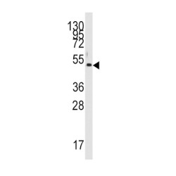 Pyruvate Dehydrogenase Kinase Isozyme 4 (PDK4) Antibody