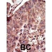 Pyruvate Kinase, Liver And RBC (PKLR) Antibody