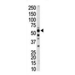 Pyruvate Kinase, Liver And RBC (PKLR) Antibody