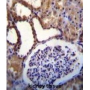 WNK Lysine Deficient Protein Kinase 3 (WNK3) Antibody