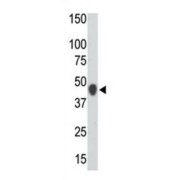 Creatine Kinase, Mitochondrial 2 (CKMT2) Antibody