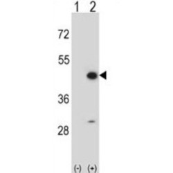 Creatine Kinase, Mitochondrial 2 (CKMT2) Antibody