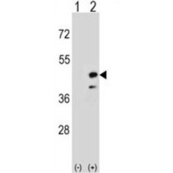 Creatine Kinase, Mitochondrial 2 (CKMT2) Antibody