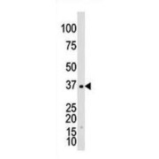 Galactokinase (GALK1) Antibody