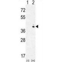 Galactokinase (GALK1) Antibody